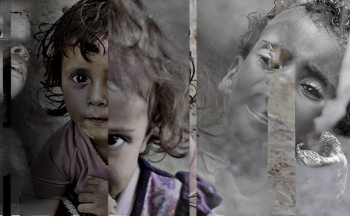 Δύο εκατομμύρια παιδιά υποφέρουν από την πείνα στην Υεμένη