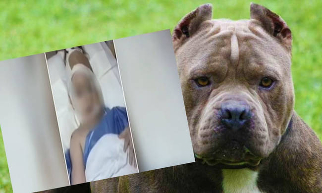 Επίθεση σκύλου σε κοριτσάκι 3 ετών