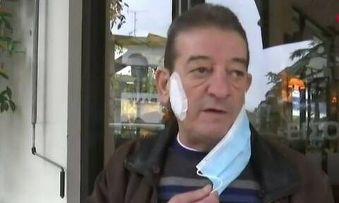 Άνδρας δάγκωσε ιδιοκτήτη καφέ στο μάγουλο γιατί του ζήτησε το πιστοποιητικό εμβολιασμού